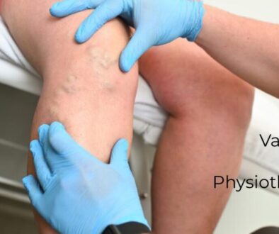 Varicose Veins Physiotherapy